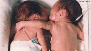 Hug Twin Babies